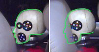 MovXact Analysis: Head Stencil with Reference Markers